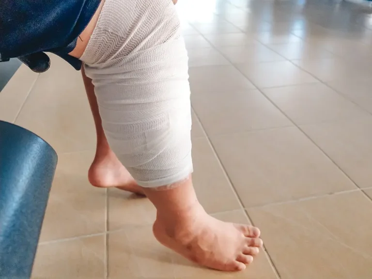 A person's leg and knee wrapped in a thick white medical compression bandage or gauze sitting in a clinical waiting room.