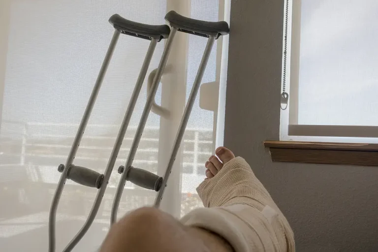 A first-person perspective of a patient's leg in a heavy white medical cast and bandage resting in front of a pair of silver crutches leaning against a sunlit window, representing post-accident recovery, orthopedic injury, and the need for personal injury legal advocacy.